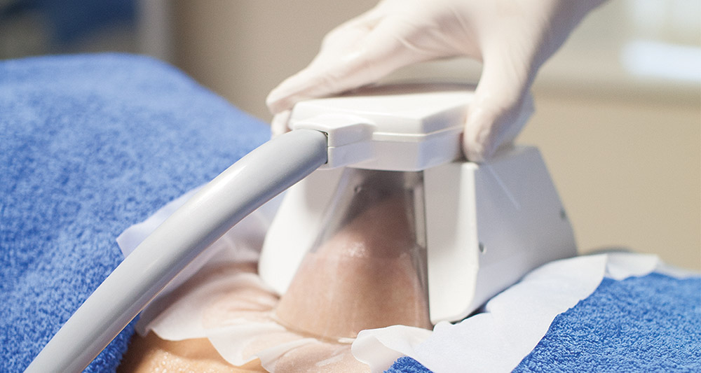 How Fat Freezing and HIFU Work Together? 2 Multiple Areas in One Session HIFU and Fat Freezing Scotland