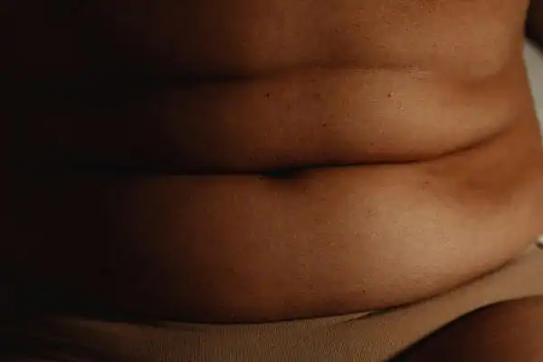 The Hidden Connection: How Stress Shapes Your Fitness and Body Composition 3 image of what stress can do on the stomach area and how Lipo 360 Scotland can help to change your body shape.