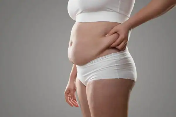 Image of stress belly Scotland How Lipo 360 can help manage your symptoms